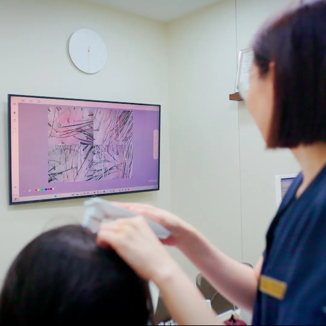 더모스코피 정밀 검사